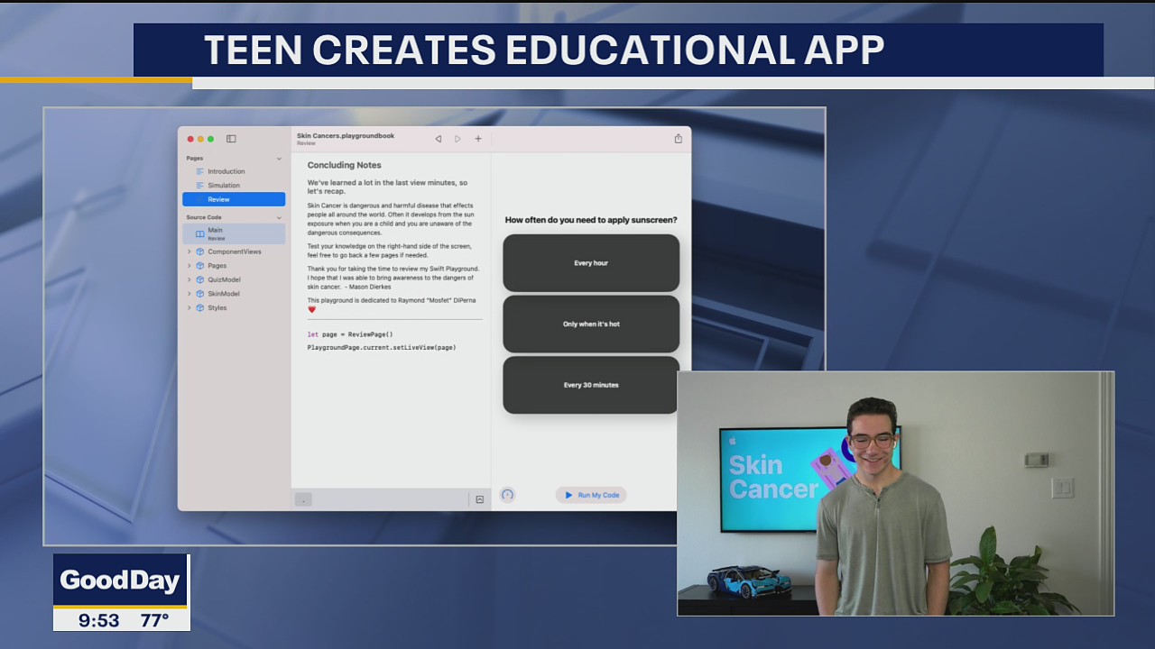 Frisco teen creates educational skin cancer app