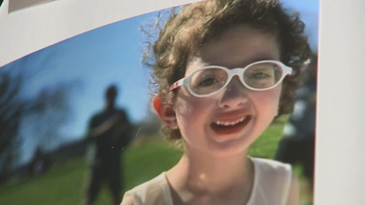Jackson girl dies after tooth extraction