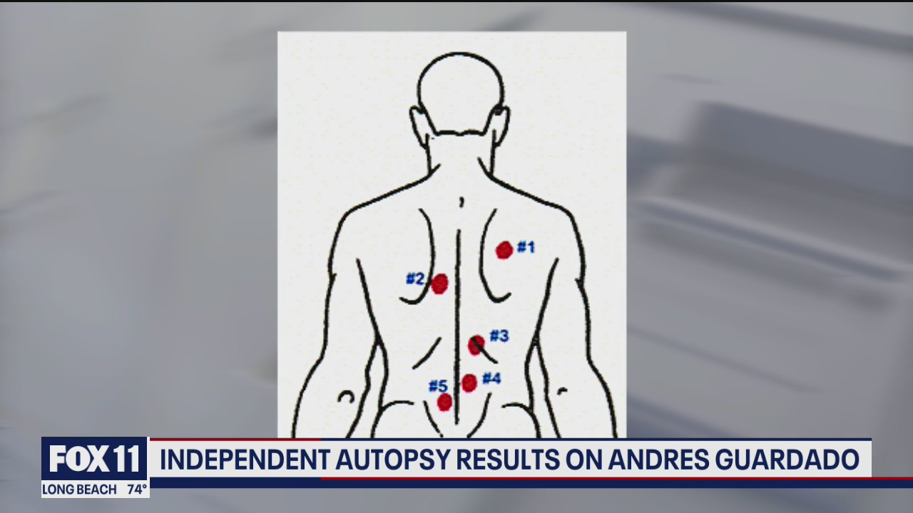 Independent autopsy results on Andres Guardado