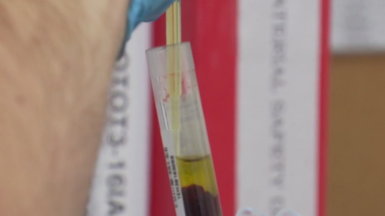 Clinical research trials to test COVID-19 vaccines being conducted in Austin