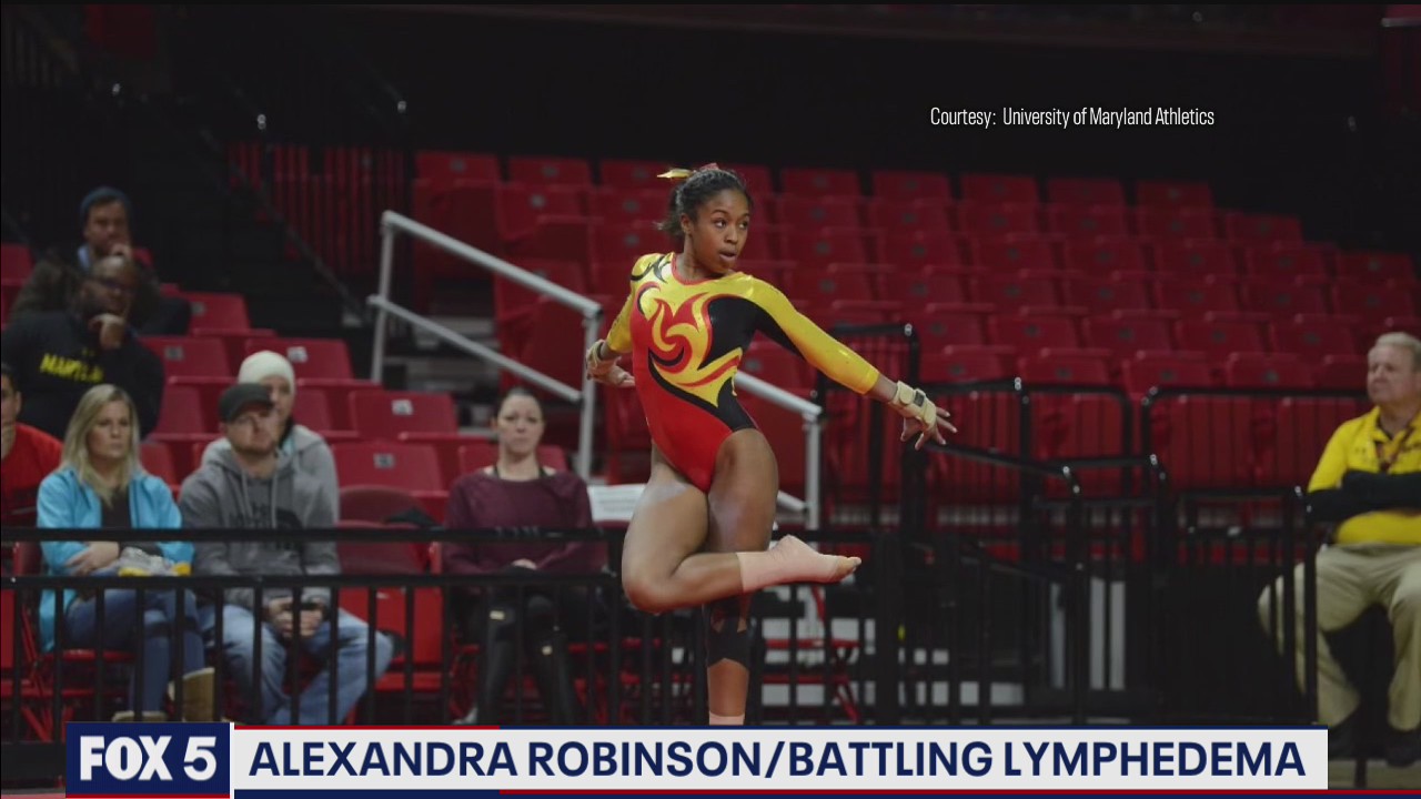 Former UMD gymnast battling rare incurable disease plans surgery to combat illness