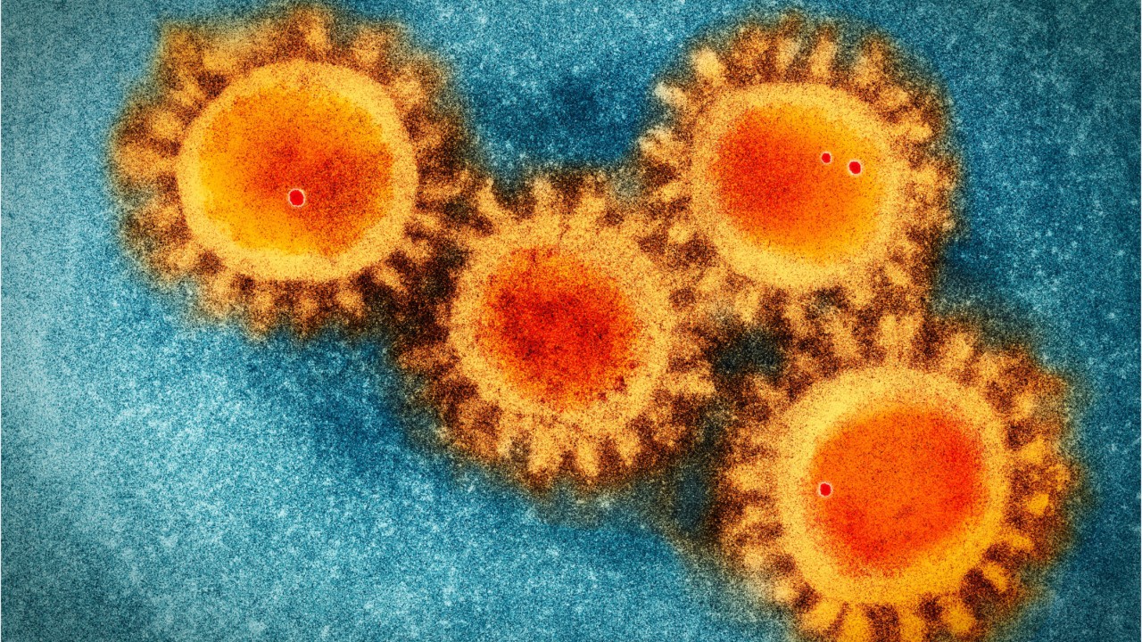 CDC expands list of high-risk conditions for COVID-19 complications