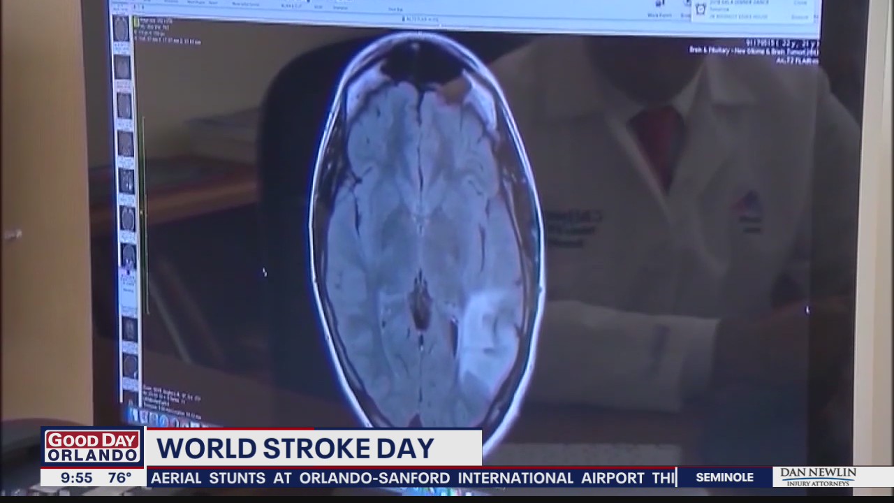 World Stroke Day