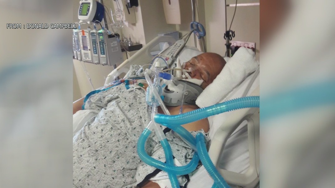 Cyclist who suffered traumatic brain injury in hit-and-run still on road to recovery