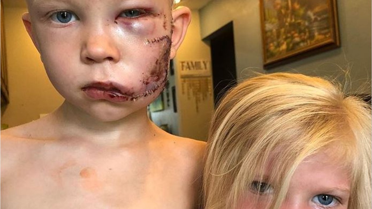 Boy, 6, saves little sister from dog attack