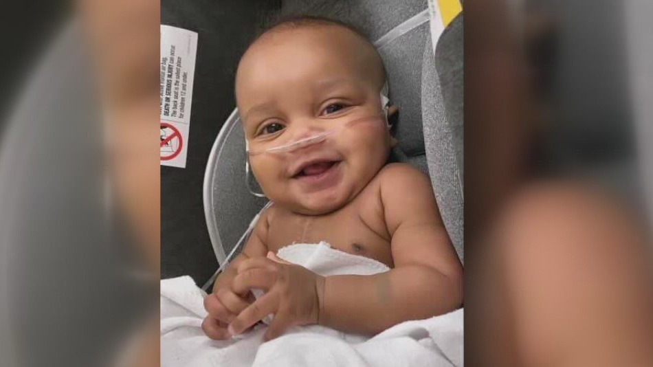 Houston doctors saved the life of a little Mississippi boy