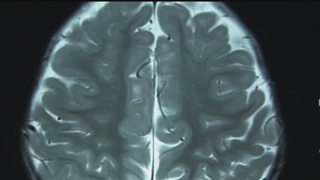 Looking at how pandemic changed our brains