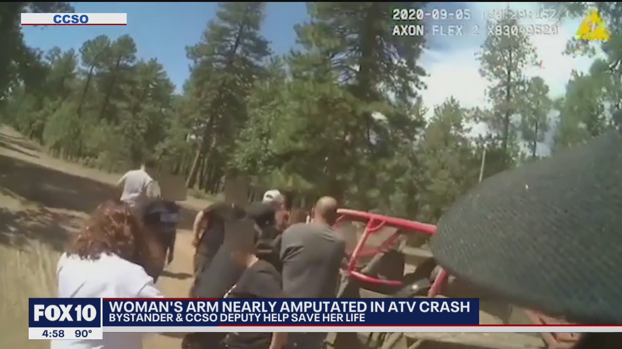 Bystanders, CCSO deputy help save woman's life after her arm was nearly severed in crash