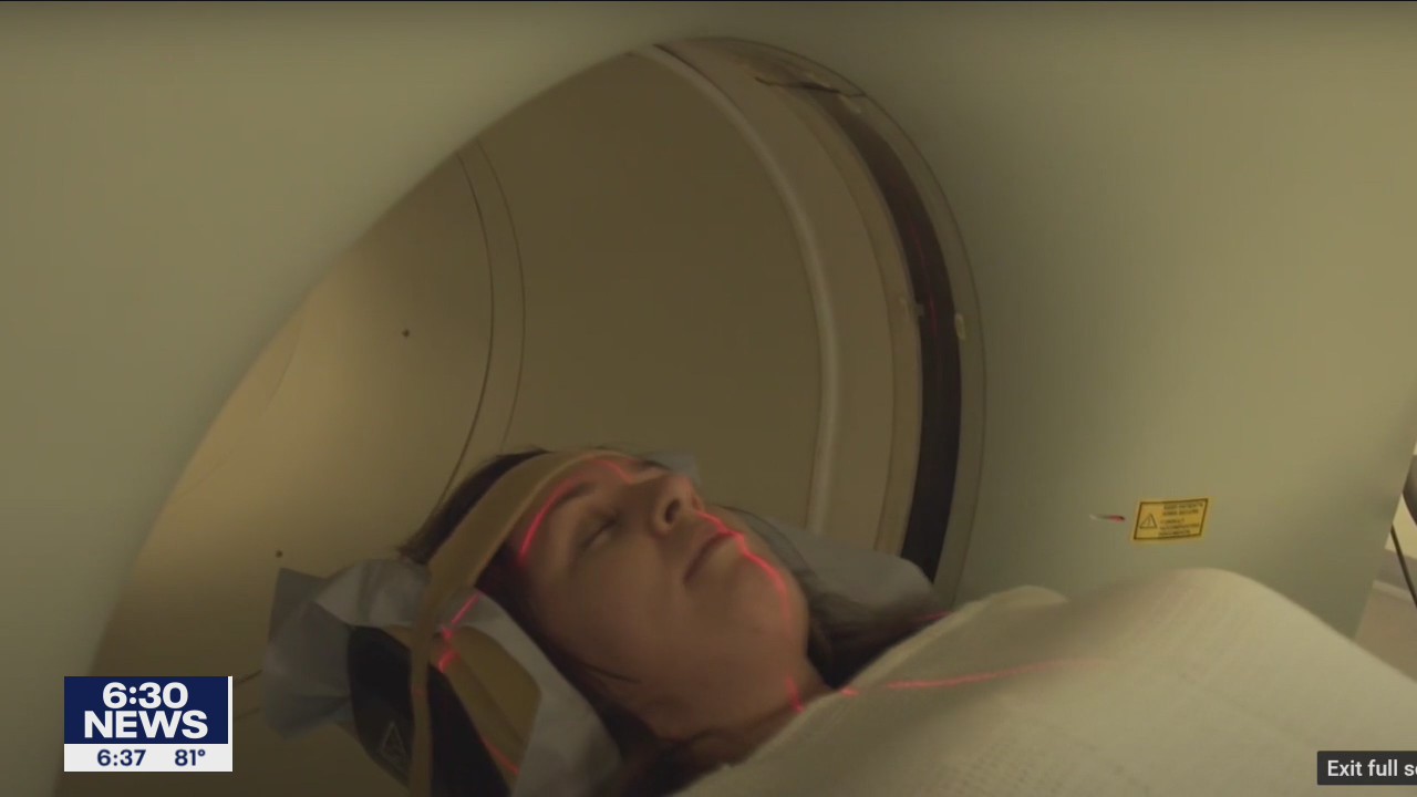 Risk factors for Alzheimer's disease could start in adolescence