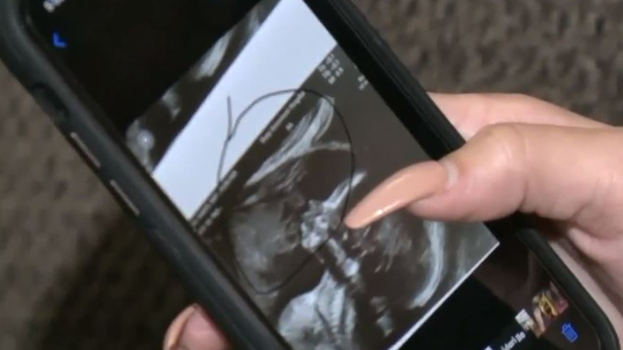 Pregnant woman claims she sees late father's face alongside daughter's in ultrasound photo