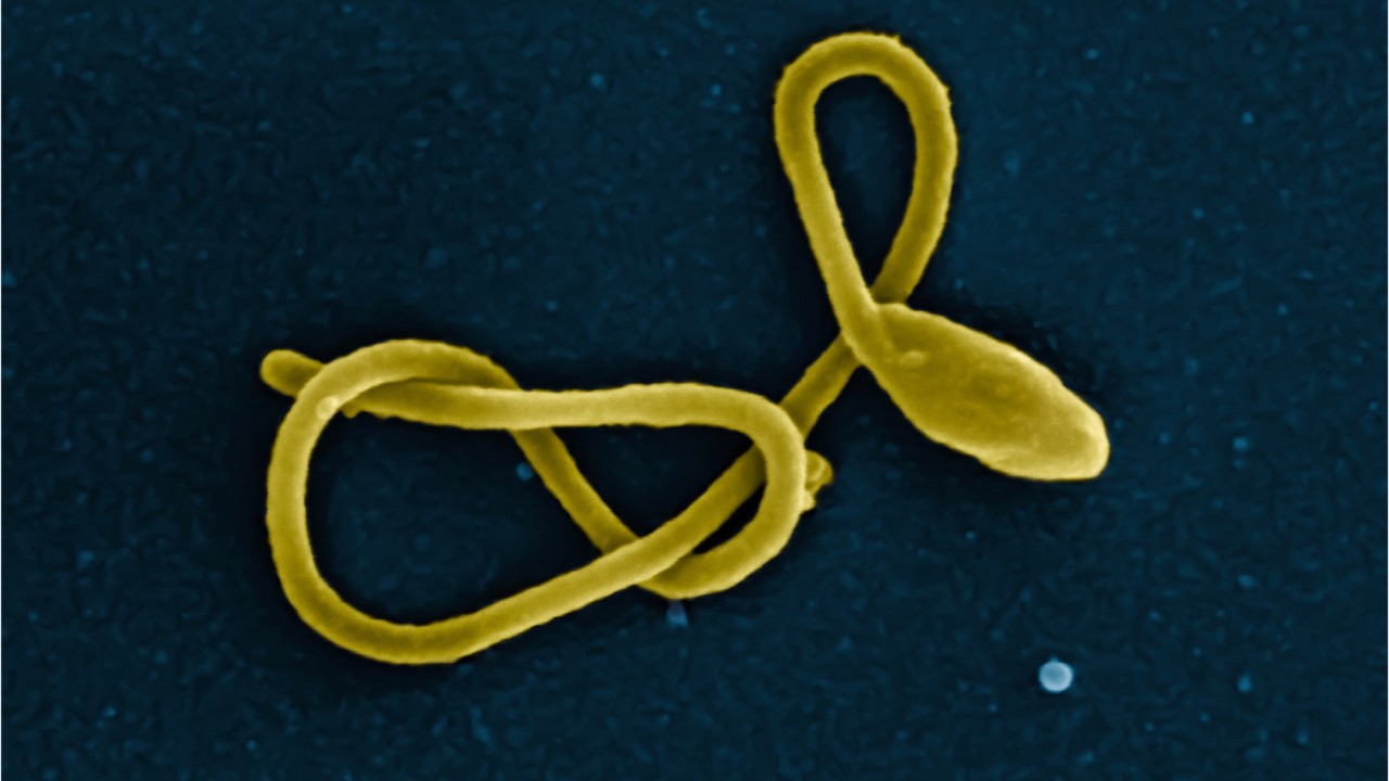 What is Ebola virus?