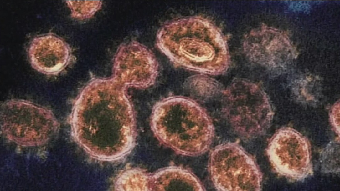 New Lambda COVID-19 variant detected in Houston hospital this week