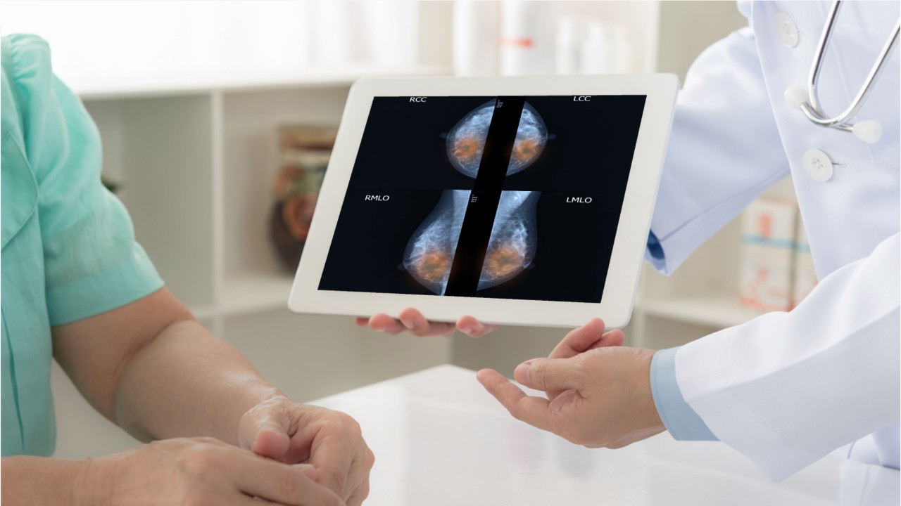 Simple blood test shows potential to provide early warning for breast cancer, researchers say
