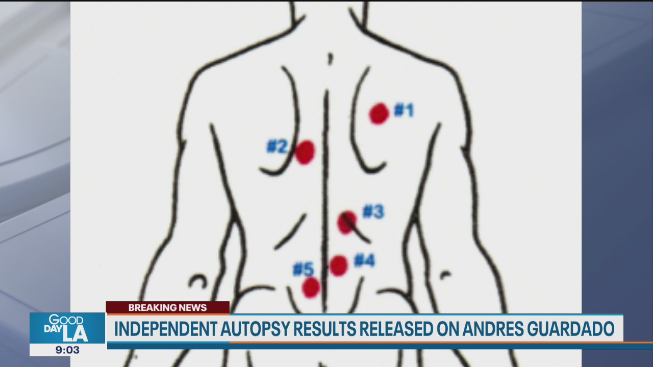 Andres Guardado was shot in the back five times by sheriff's deputy, family autopsy finds