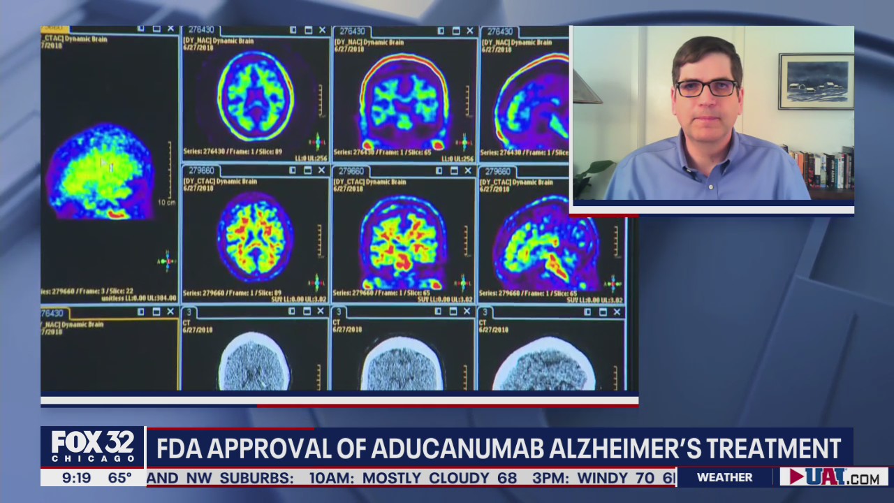 FDA approves new drug for Alzheimer's