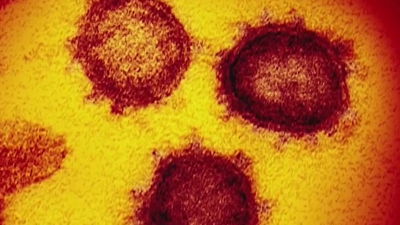 CDC shows how severe COVID-19 impacts people with underlying health conditions