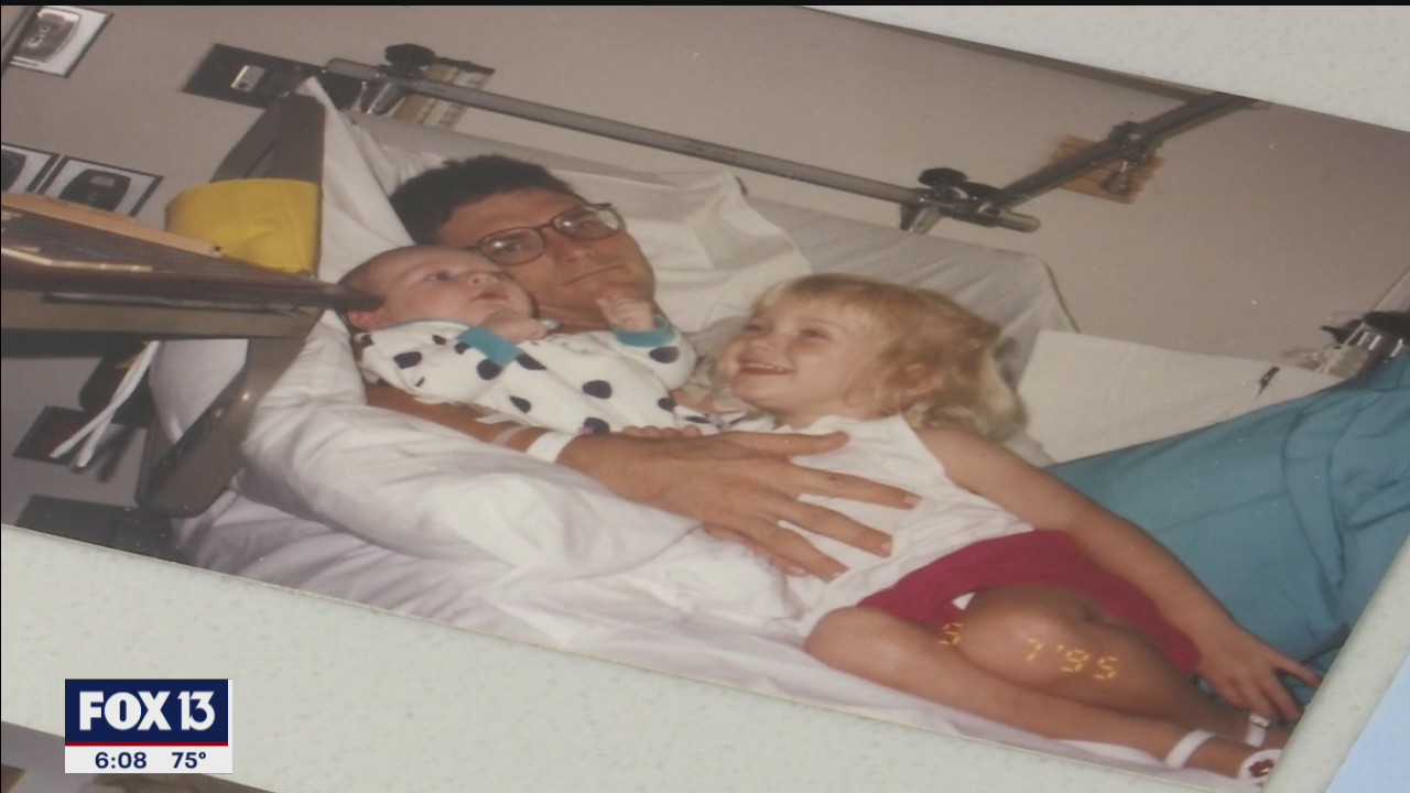 Burn victims face lifetime of recovery