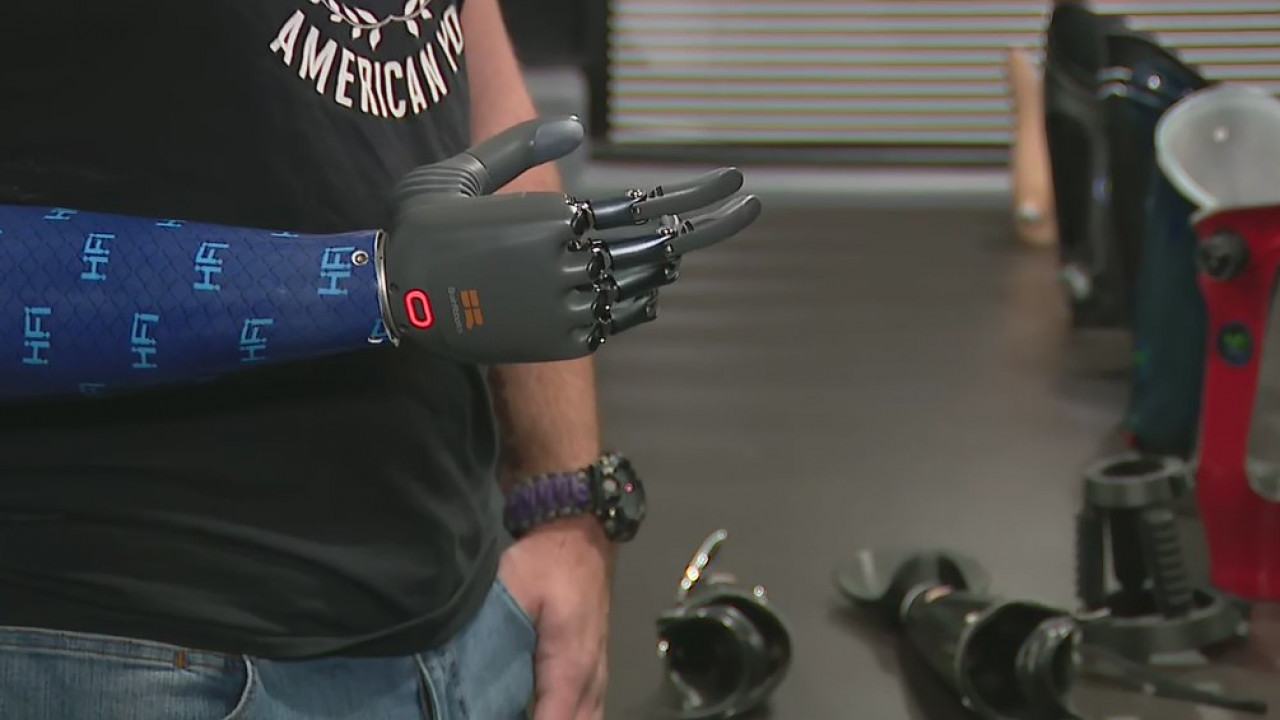 Westlake Village prosthetics company tests state-of-the art bionic hand