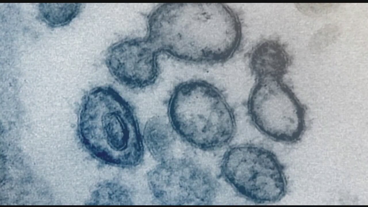New coronavirus variant reaches California