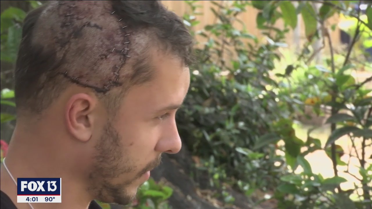 Gator attack survivor says he believes reptile was protecting its nest