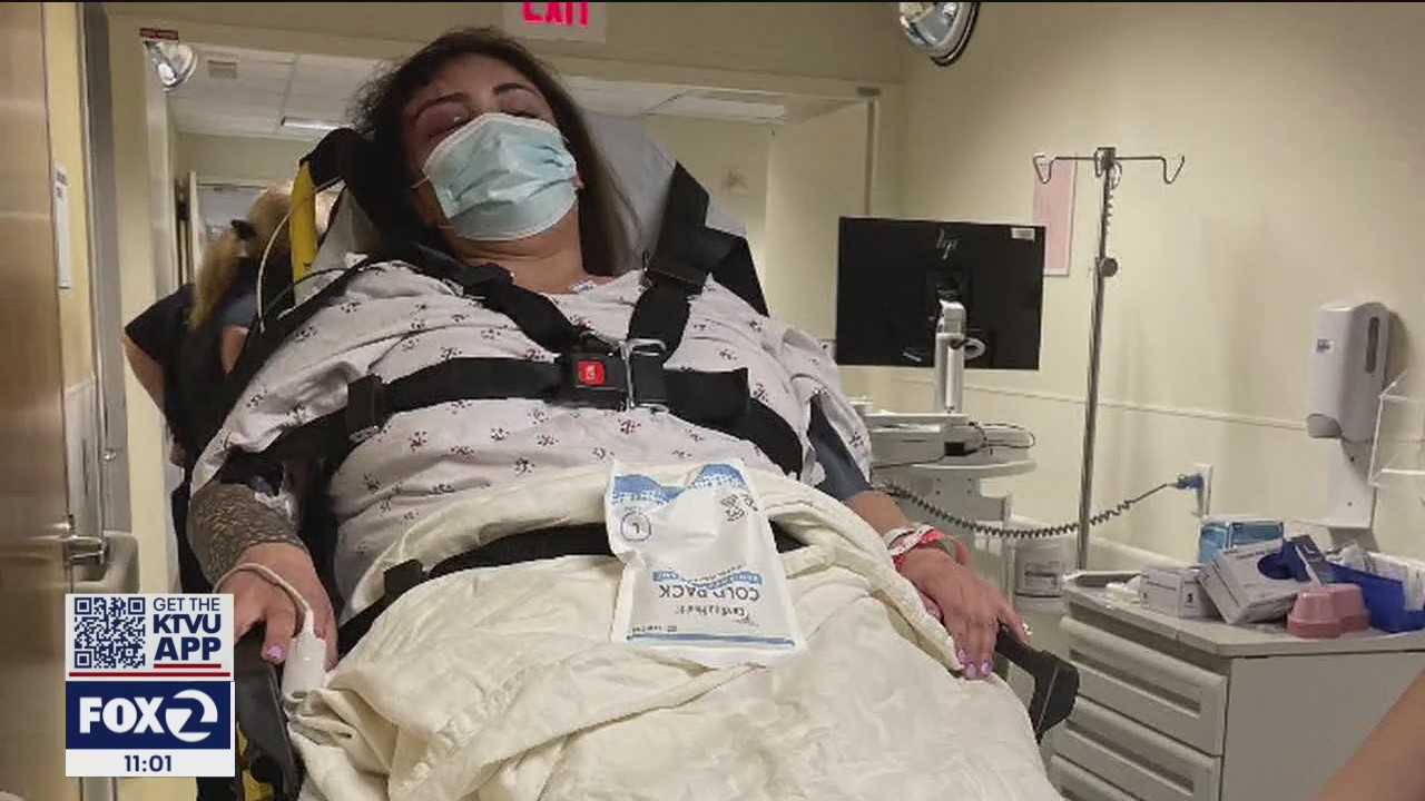 San Jose woman says she was attacked, robbed leaving bar