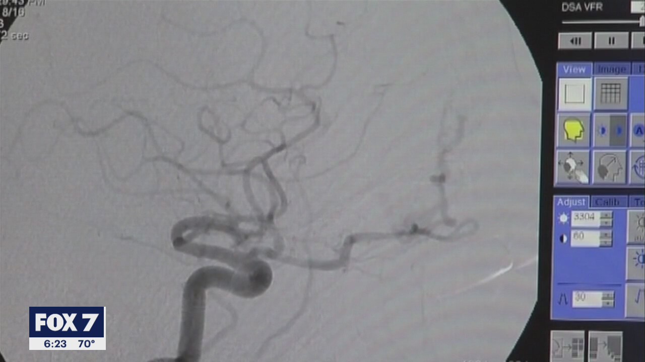 Stroke Awareness Month