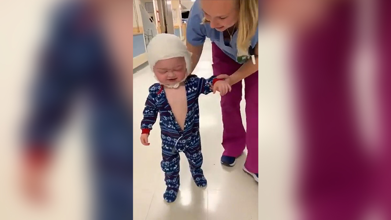 Mom shares heartwarming video of 23-month-old son walking days after intensive skull surgery