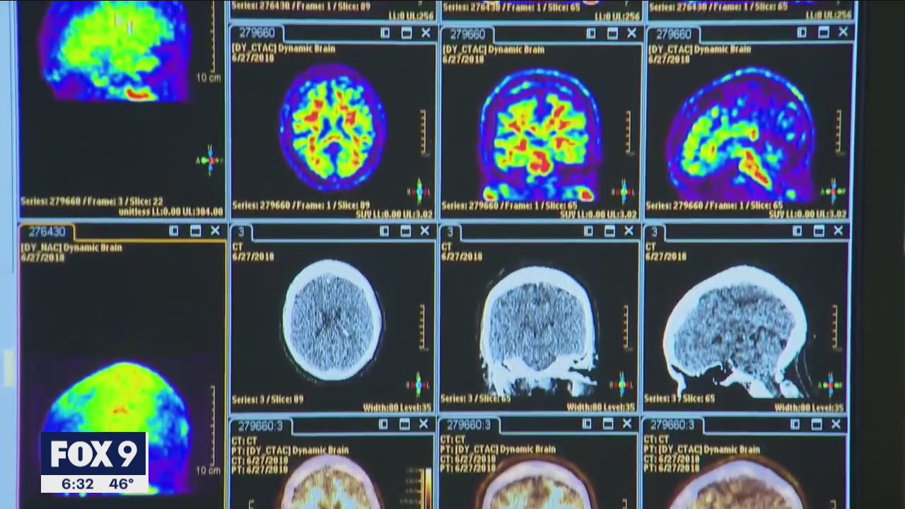 New data shows disparities among ethnic groups in views toward Alzheimer's care