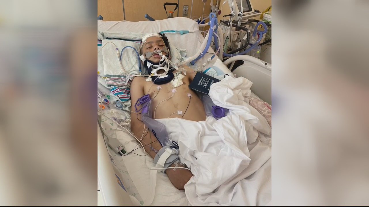 Teen boy fights for his life after being hit on his minibike