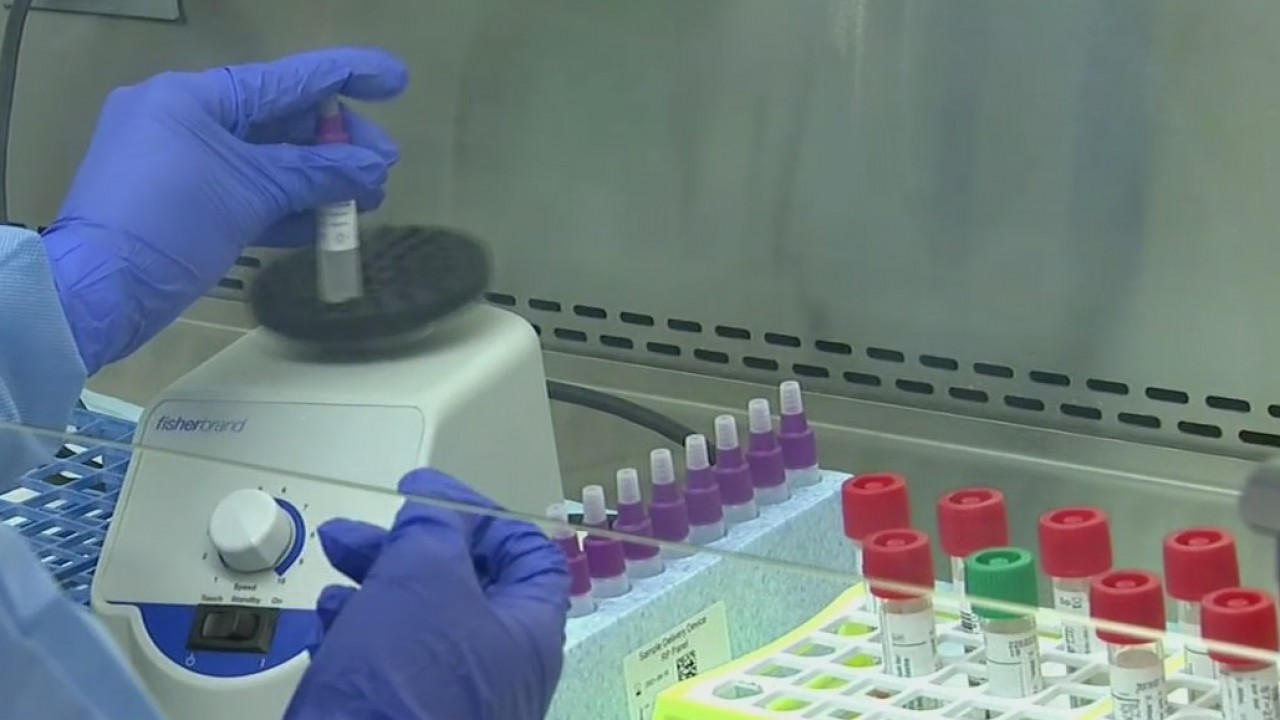 Delays in COVID-19 test results