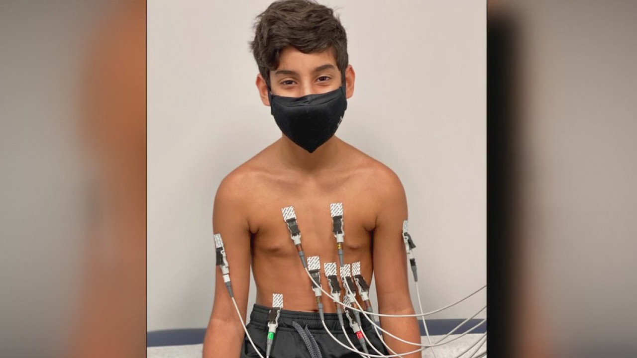 Doctors concerned about long-term effects on children who had COVID-19