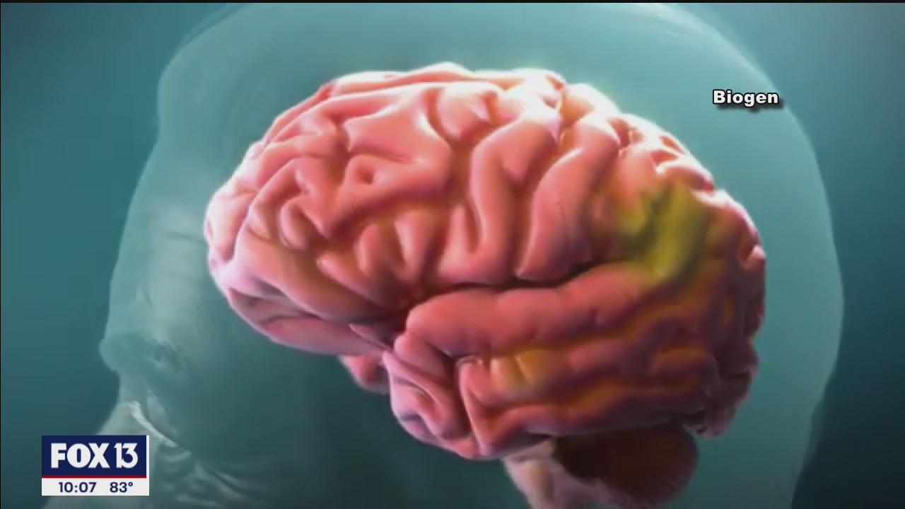 FDA approves controversial Alzheimer's drug