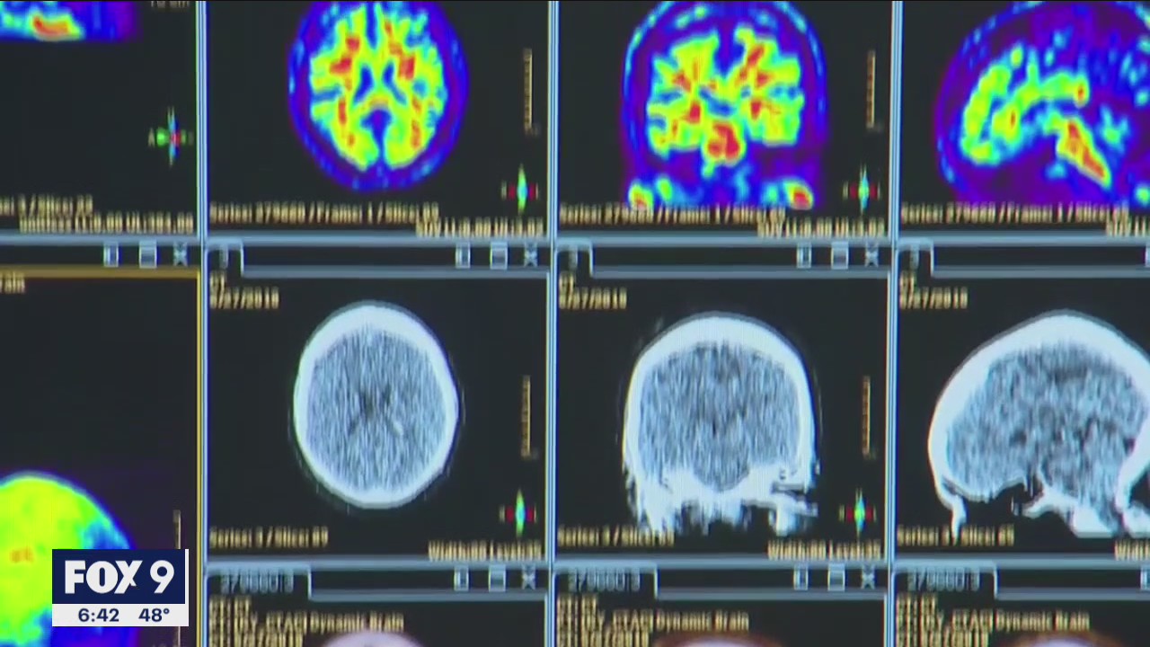 Minnesota native will conduct important Alzheimer’s study during trip to International Space Station
