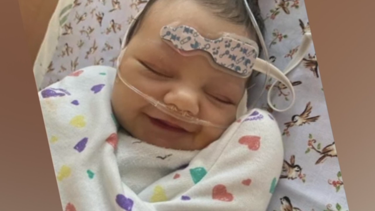 Family seeks live liver donor for their baby girl