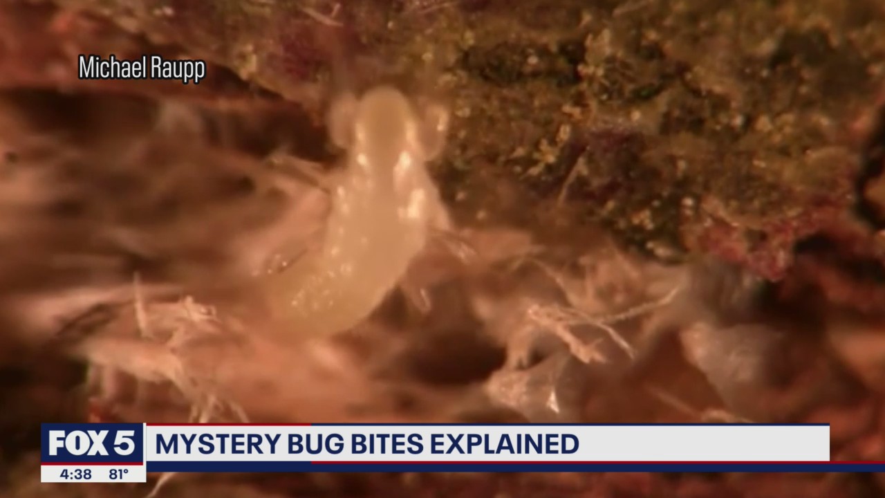 Mystery bug bites linked to cicadas, experts say