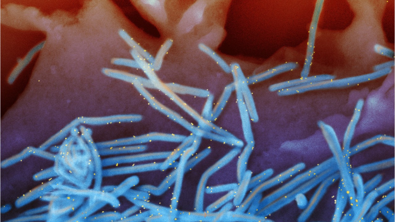 What is respiratory syncytial virus (RSV)?