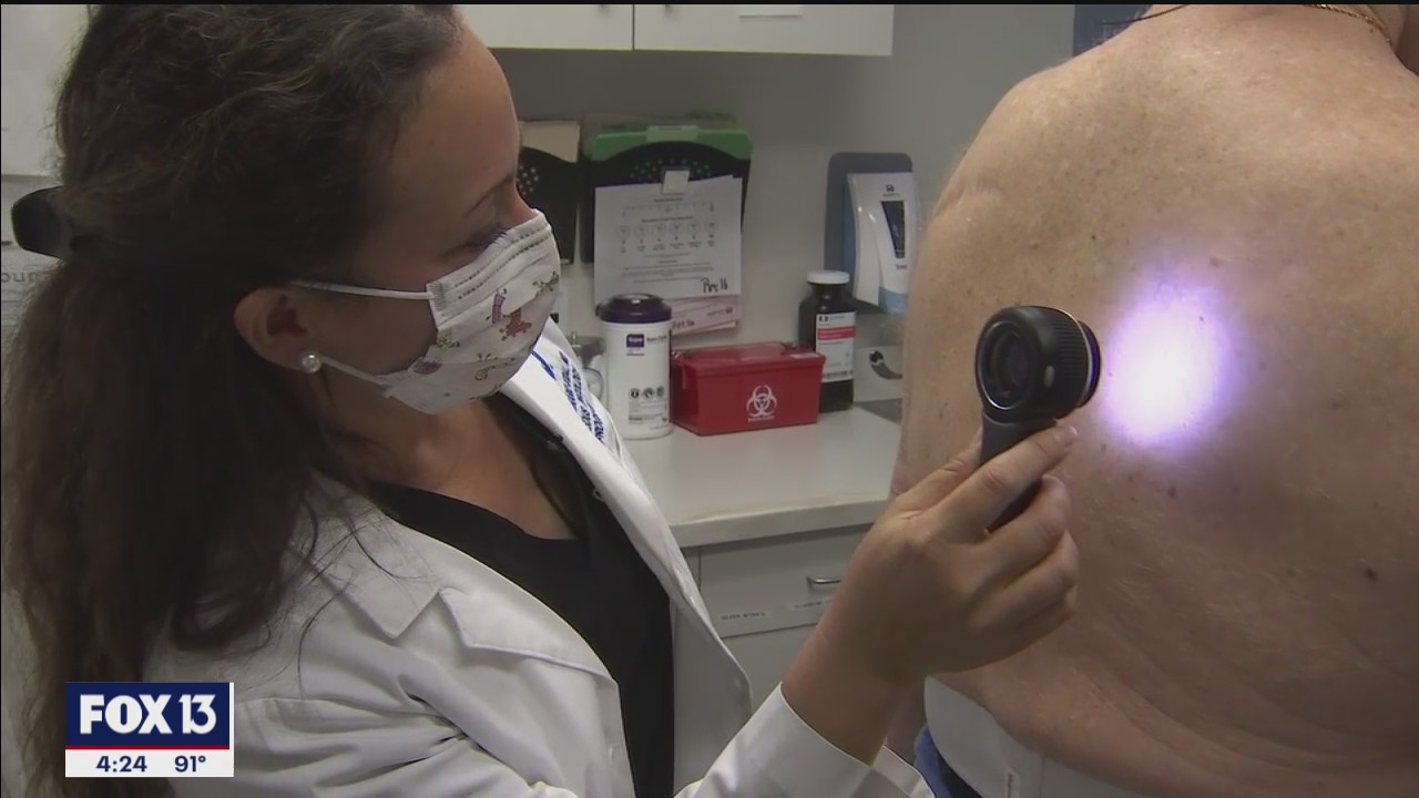 Dermatologists use the alphabet to check for melanoma