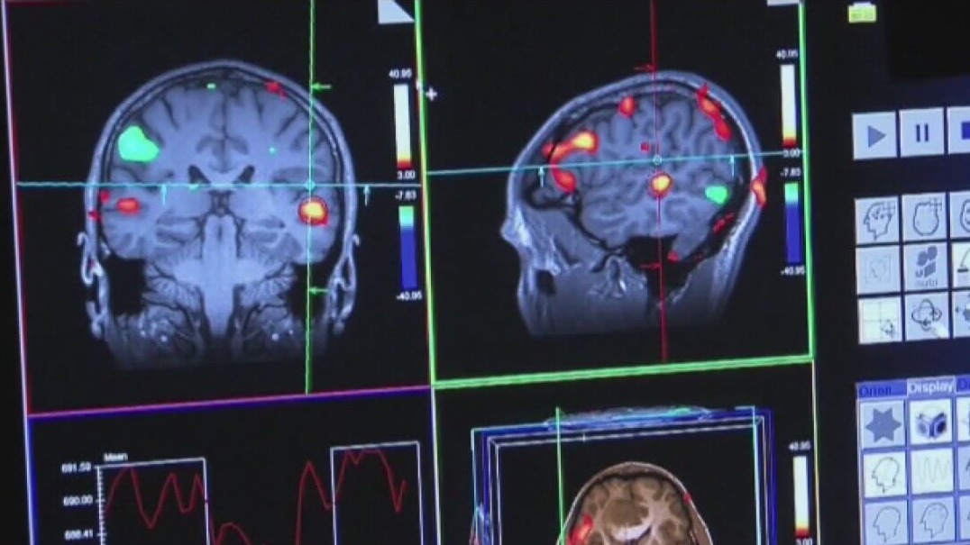 A possible approval for a new drug to fight Alzheimer’s