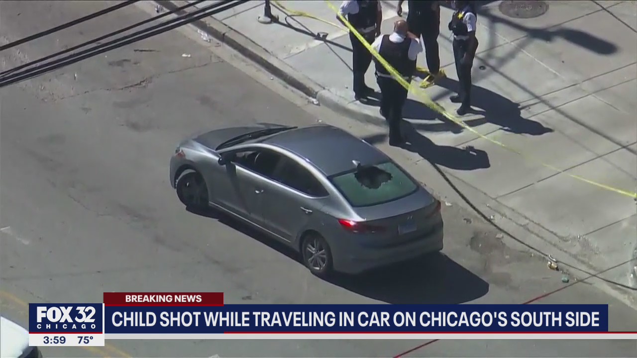 Child shot in the head on Chicago's South Side