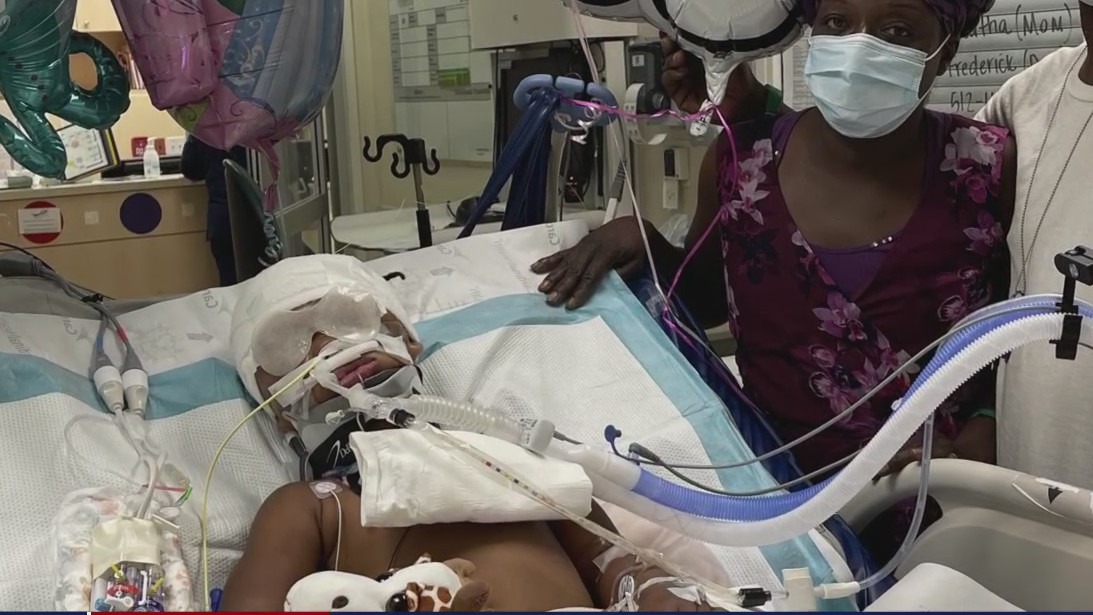 3-year-old daughter of deaf parents shot during drive-by in North Houston