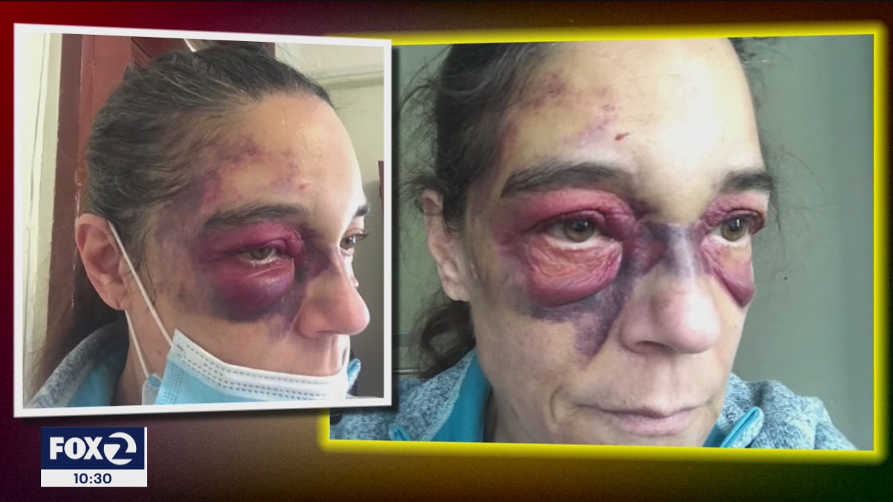 Grandma ends up bruised in Santa Rita Jail after calling 911 for help 18 hours ago