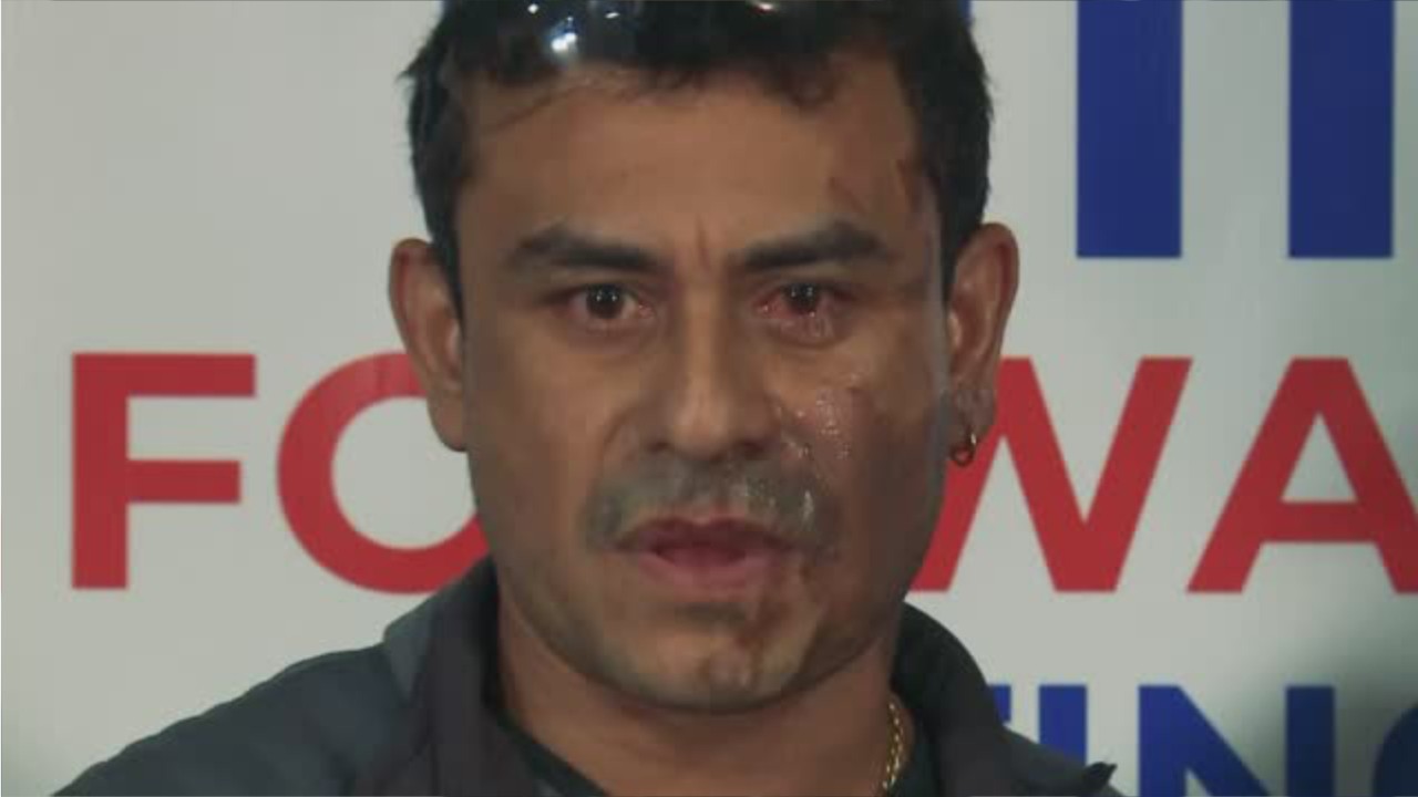 Family says suspect in acid attack is veteran, suffered PTSD