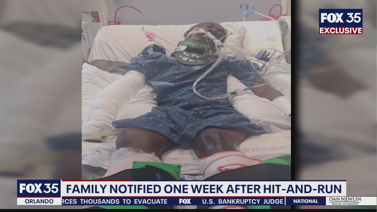 Man, 73, critical after hit and run in Poinciana