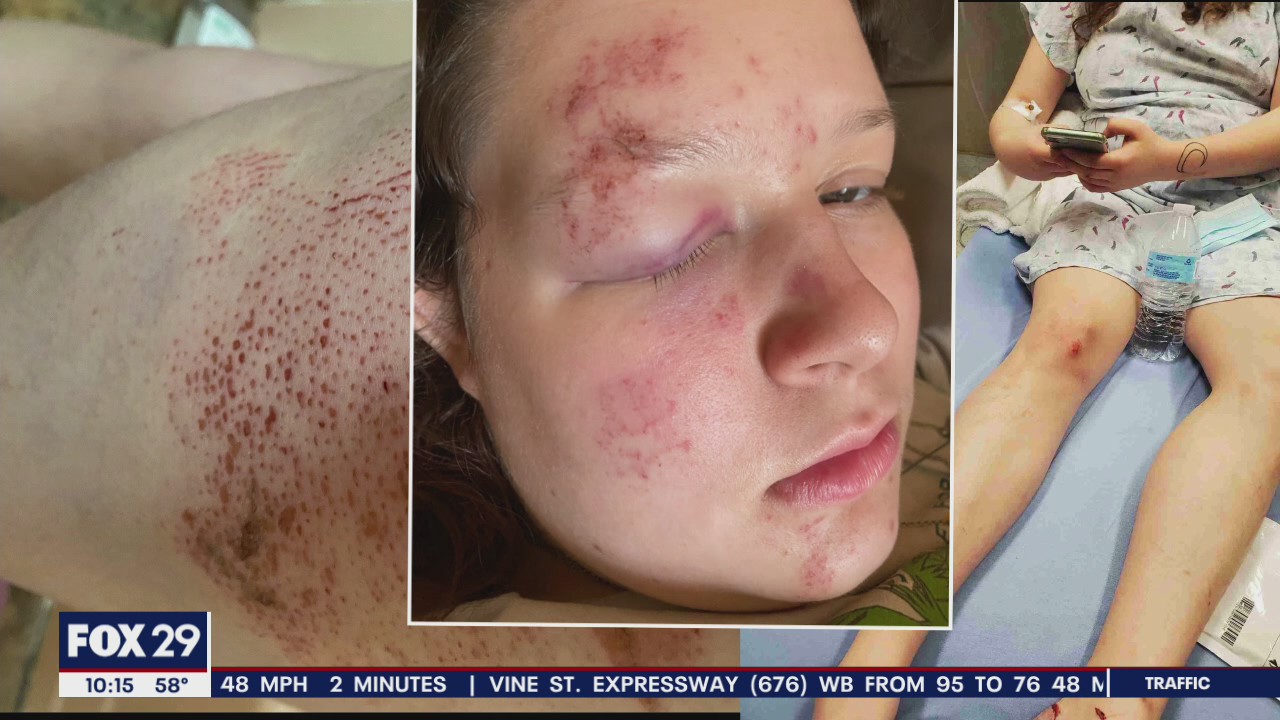Mother pleads for hit-and-run driver to turn themselves in