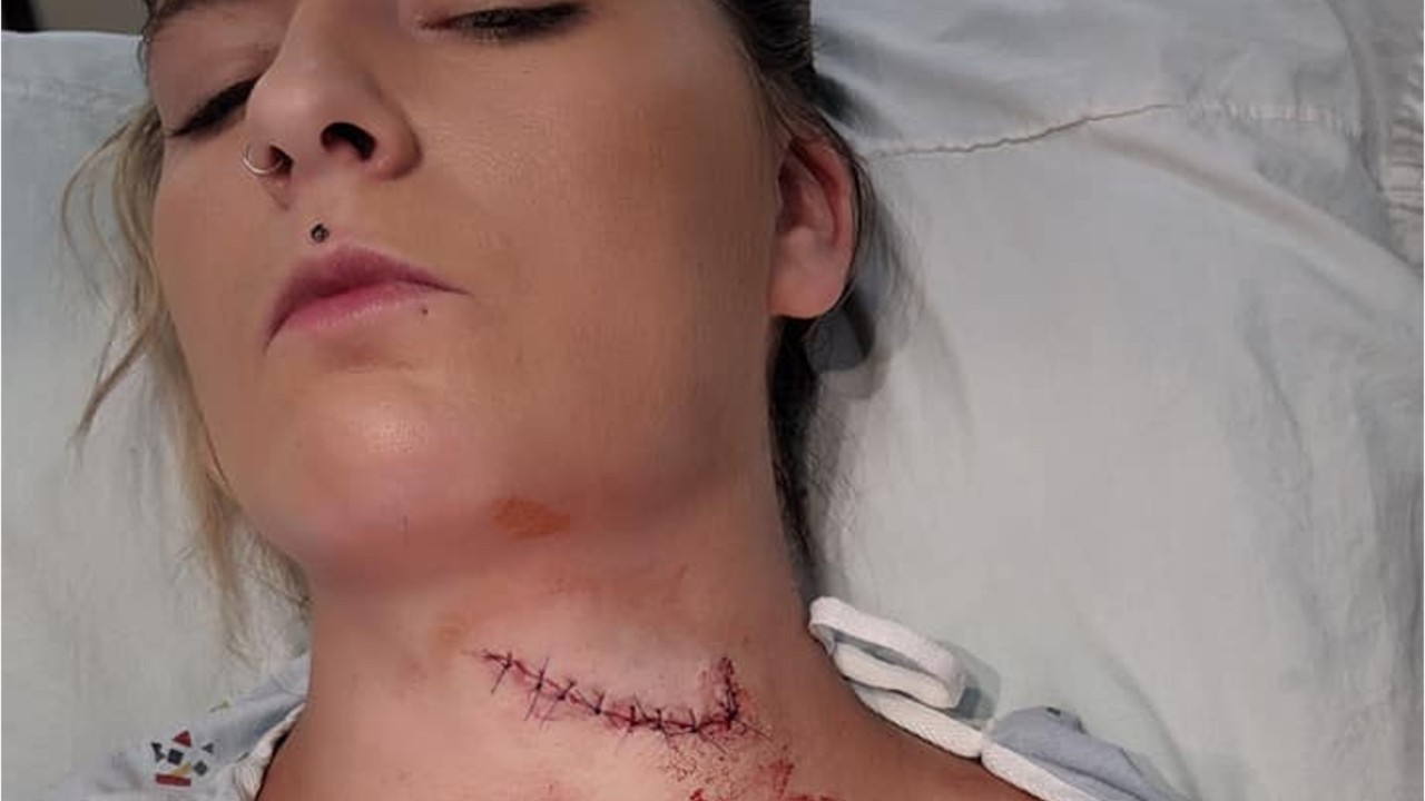 Woman survives freak lawn mower accident that left her neck sliced open
