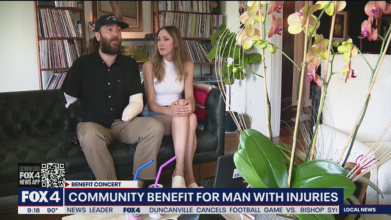 Benefit concert organized for Dallas musician who became a double amputee