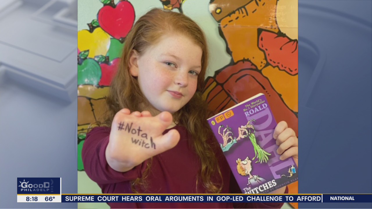 Portrayal of witches in new movie sparks movement to celebrate those with limb differences