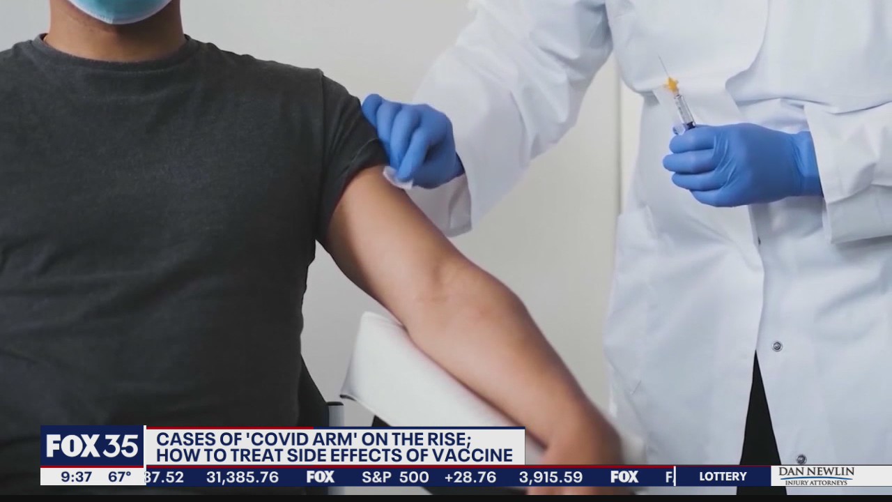 Cases of 'COVID arm' on the rise
