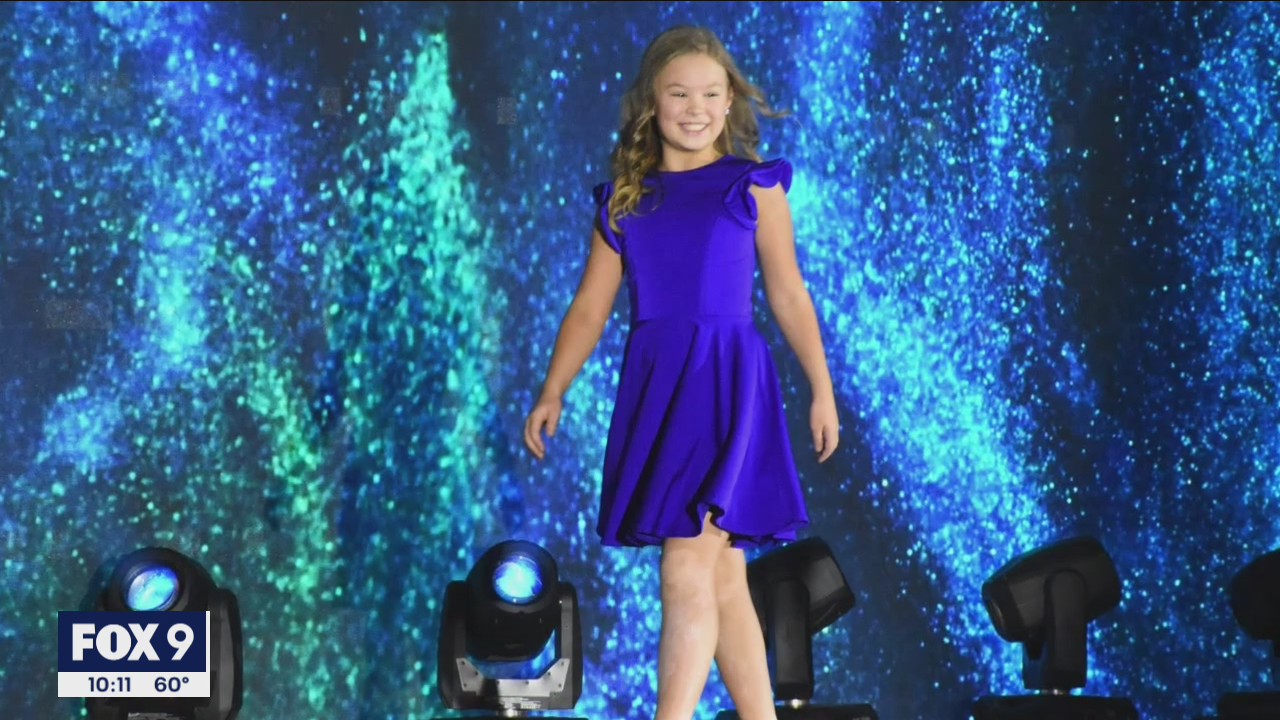 Miss Minnesota Jr., living with vitiligo, uses her platform to empower others