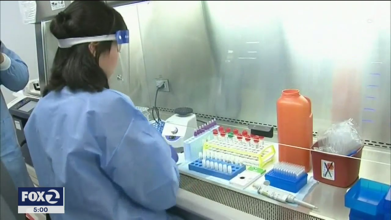 Much of California's COVID-19 testing backlog processed over weekend